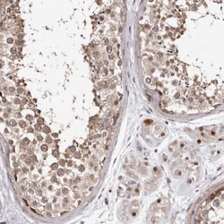 PHF20L1 Antibody, Novus Biologicals 25 &mu;L; Unlabeled:Antibodies, Polyclonal